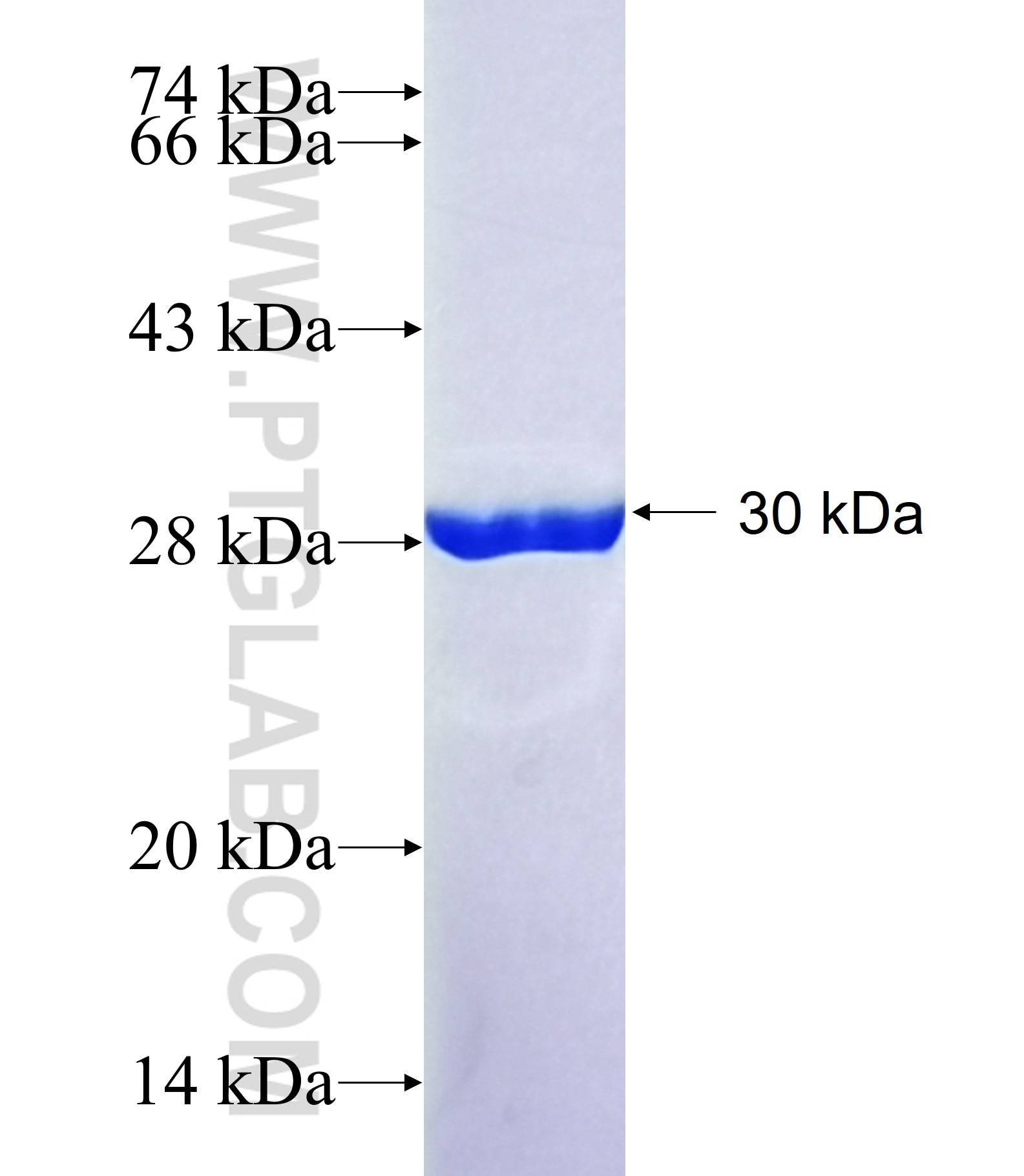 TMEM42 fusion protein Ag40872 SDS-PAGE TMEM42 fusion protein Ag40872 SDS-PAGE