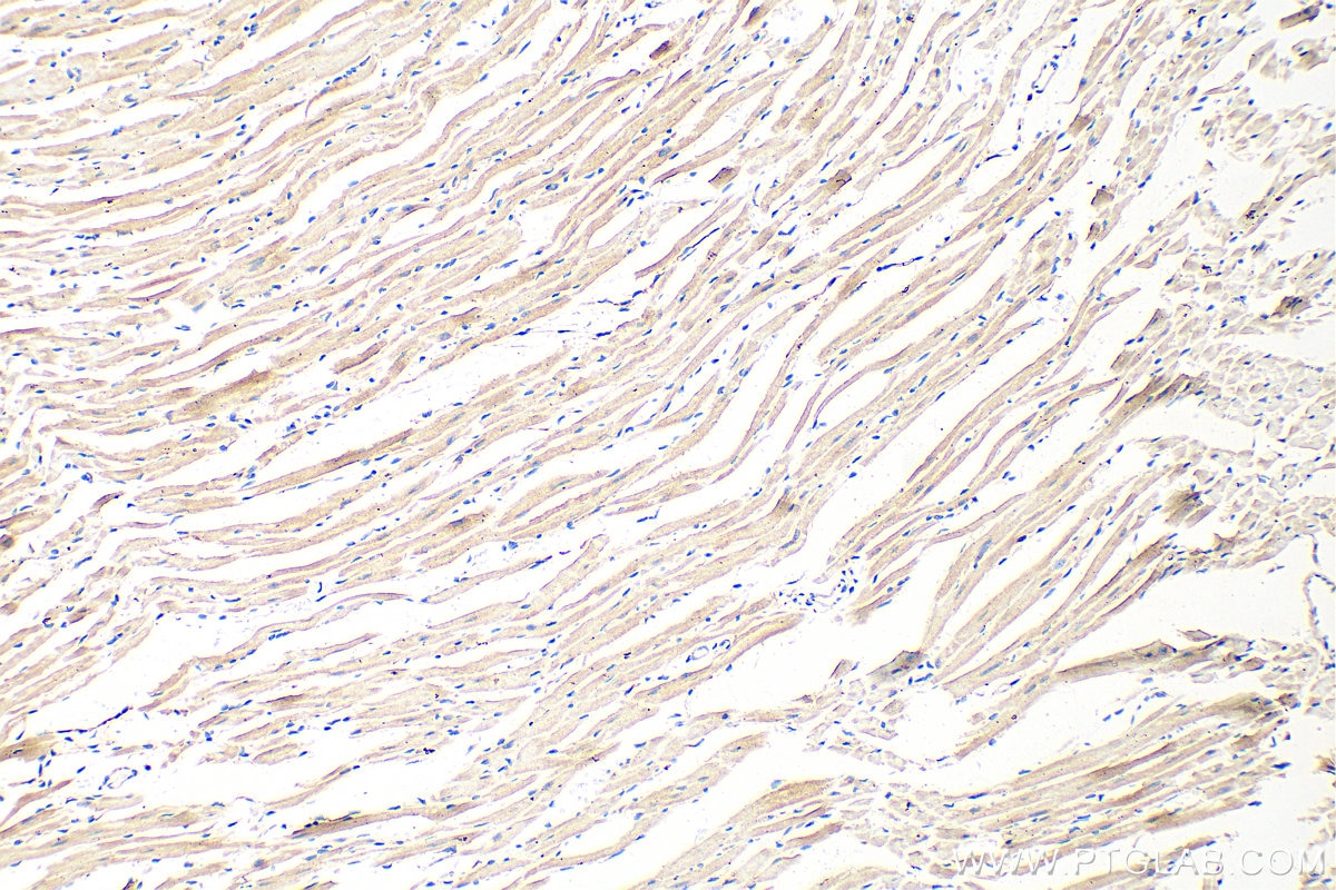 Immunohistochemistry (IHC) staining of mouse heart tissue using TMEM43 Polyclonal antibody (16362-1-AP)