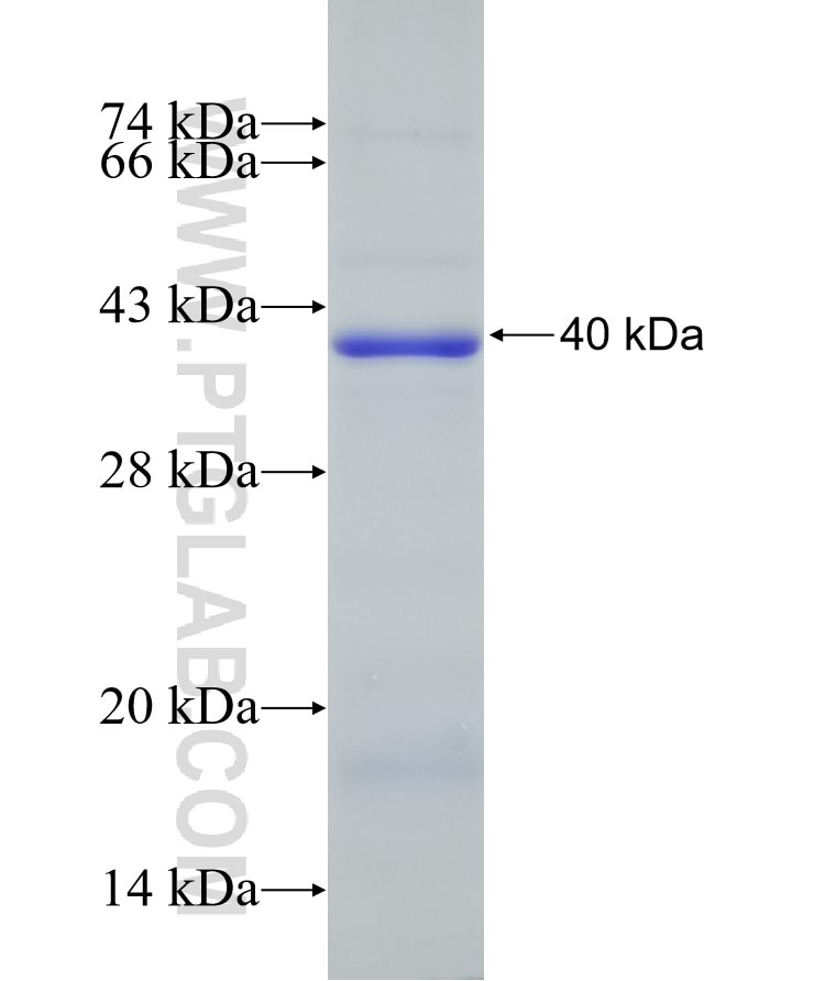 TMEM43 fusion protein Ag8522 SDS-PAGE