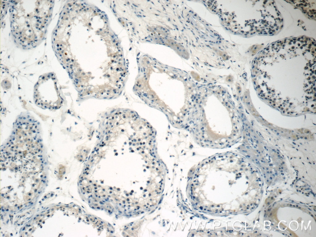 Immunohistochemistry (IHC) staining of human testis tissue using TMEM44 Polyclonal antibody (24090-1-AP)