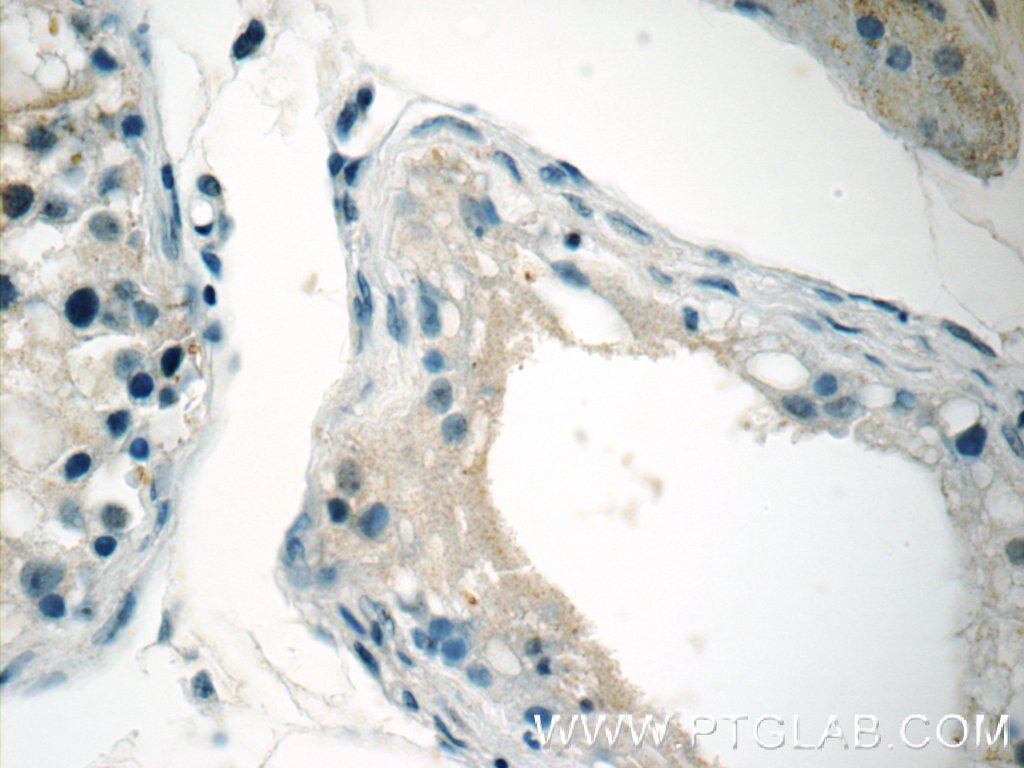 Immunohistochemistry (IHC) staining of human testis tissue using TMEM44 Polyclonal antibody (24090-1-AP)