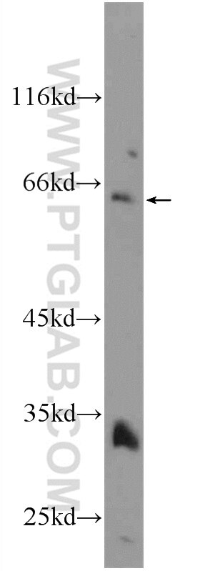 Western Blot (WB) analysis of HepG2 cells using TMEM44 Polyclonal antibody (24090-1-AP)