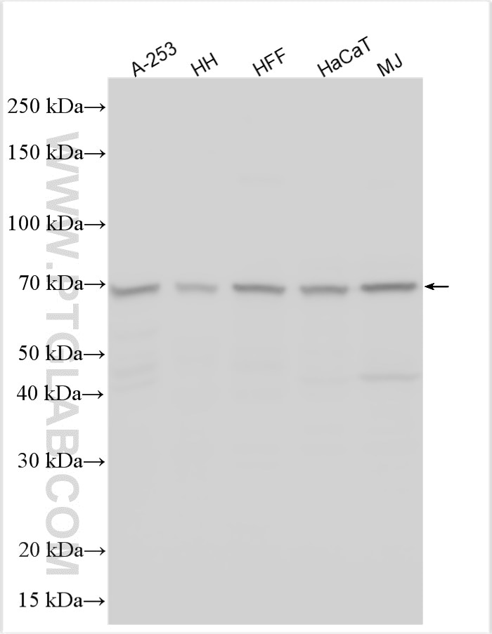 Western Blot (WB) analysis of various lysates using TMEM45A Polyclonal antibody (27534-1-AP)