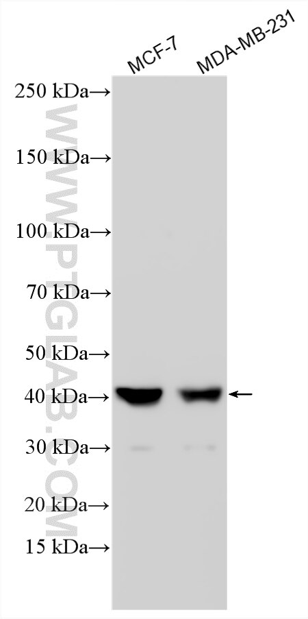 Western Blot (WB) analysis of various lysates using VMP1/TMEM49 Polyclonal antibody (24461-1-AP)