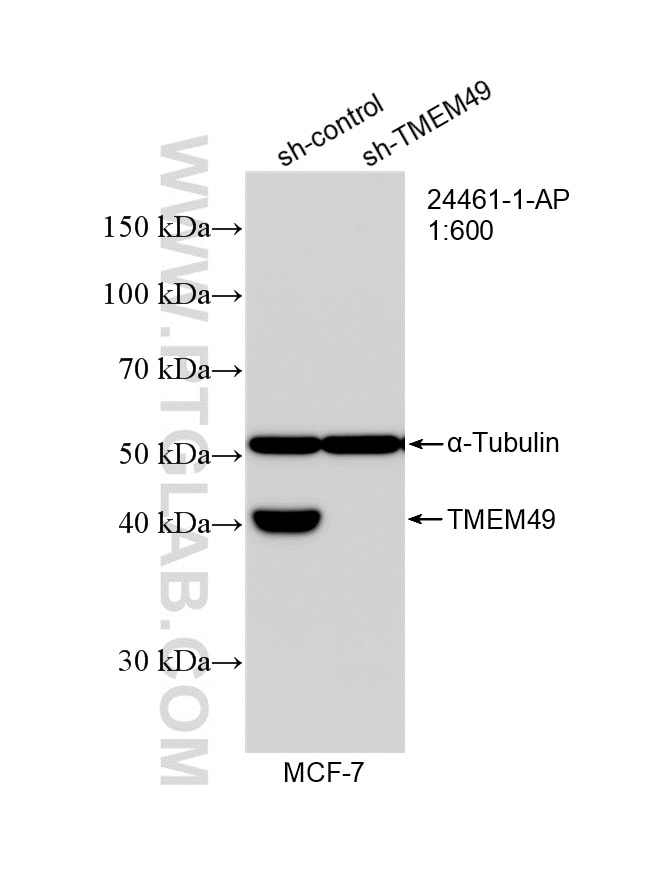 Western Blot (WB) analysis of MCF-7 cells using VMP1/TMEM49 Polyclonal antibody (24461-1-AP)