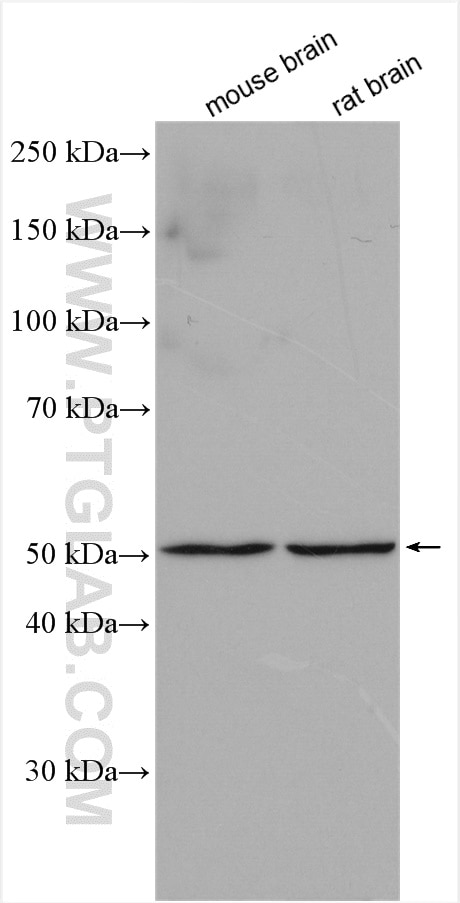 Western Blot (WB) analysis of various lysates using TMEM5 Polyclonal antibody (17095-1-AP)