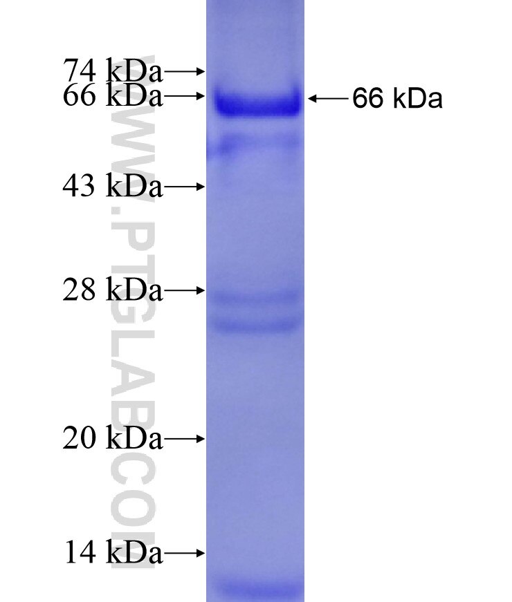 TMEM5 fusion protein Ag10562 SDS-PAGE