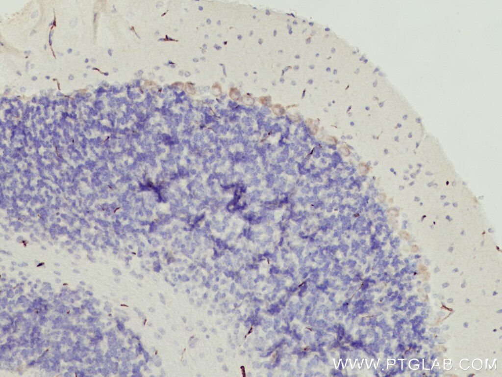 Immunohistochemistry (IHC) staining of mouse brain tissue using TMEM50B Polyclonal antibody (15941-1-AP)