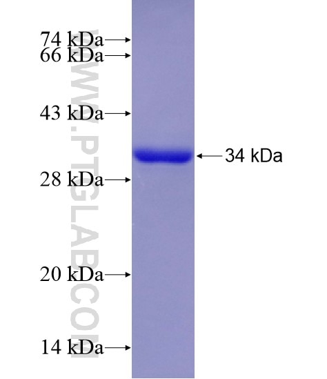 TMEM55B fusion protein Ag21172 SDS-PAGE