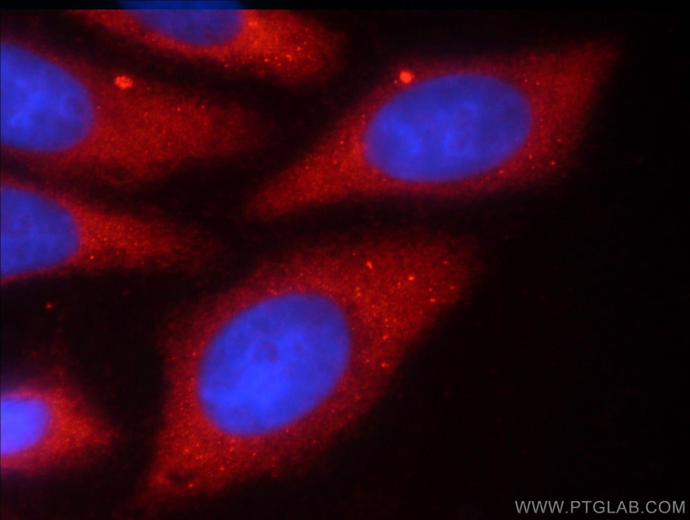 Immunofluorescence (IF) / fluorescent staining of HepG2 cells using TMEM59 Polyclonal antibody (24134-1-AP)