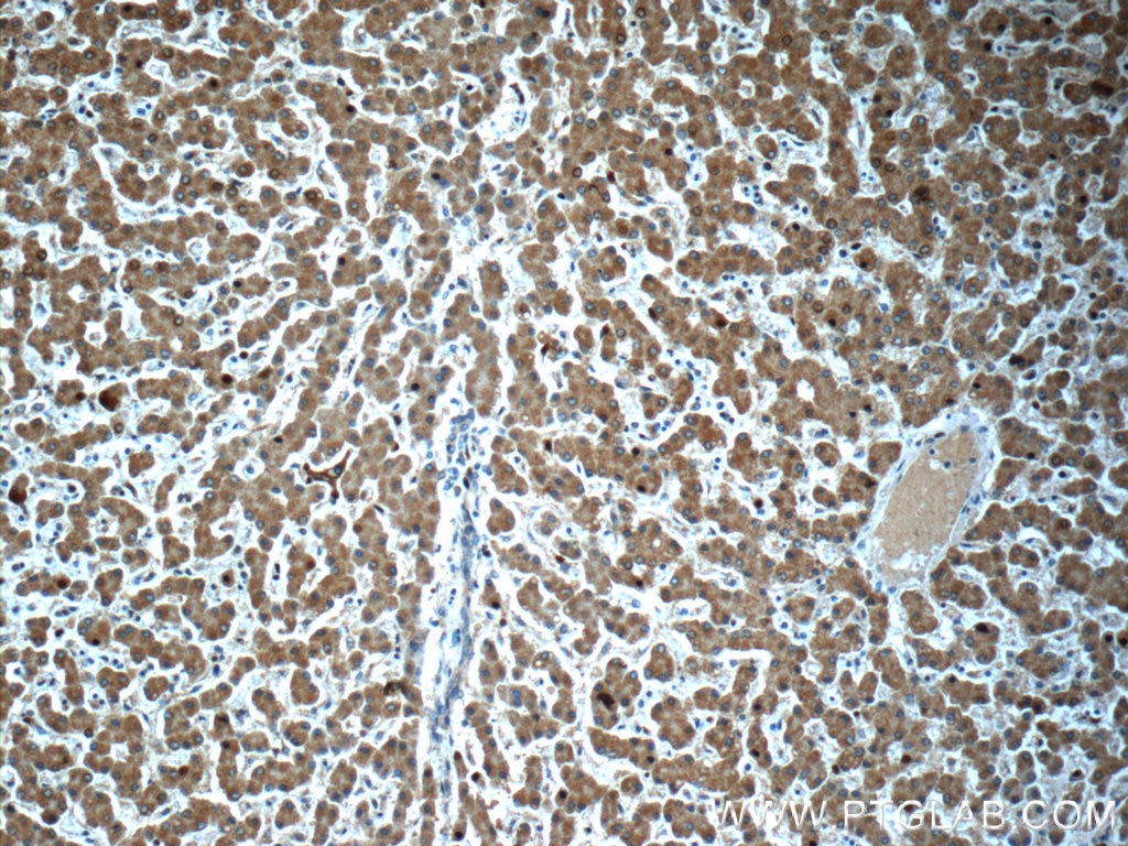 Immunohistochemistry (IHC) staining of human liver tissue using TMEM59 Polyclonal antibody (24134-1-AP)