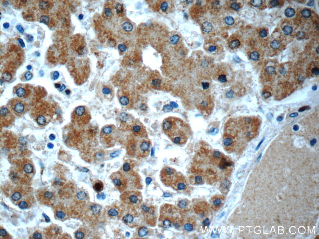 Immunohistochemistry (IHC) staining of human liver tissue using TMEM59 Polyclonal antibody (24134-1-AP)