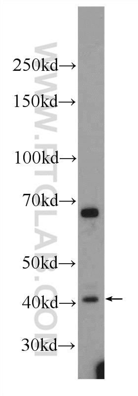 Western Blot (WB) analysis of MCF-7 cells using TMEM59 Polyclonal antibody (24134-1-AP)