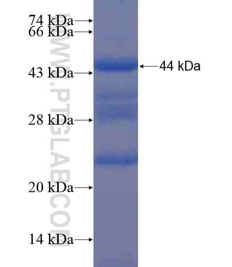 TMEM59 fusion protein Ag21150 SDS-PAGE