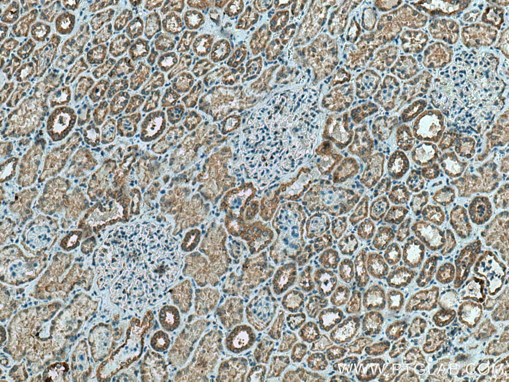 Immunohistochemistry (IHC) staining of human kidney tissue using TMEM61 Polyclonal antibody (20997-1-AP)