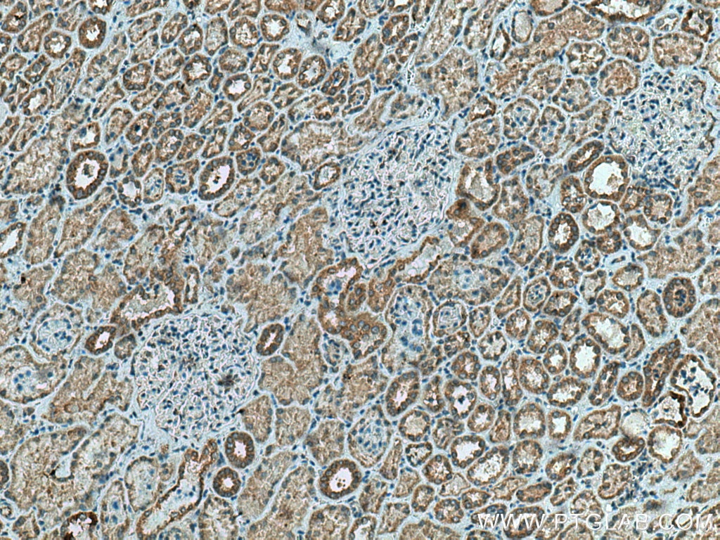 Immunohistochemistry (IHC) staining of human kidney tissue using TMEM61 Polyclonal antibody (20997-1-AP)