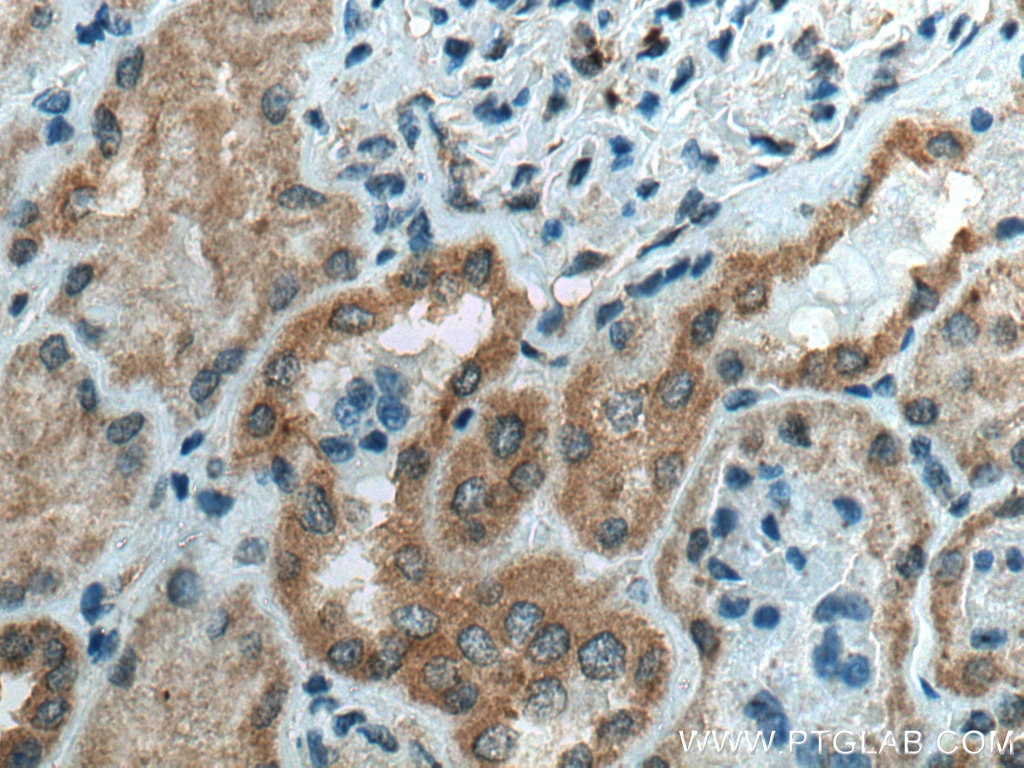 Immunohistochemistry (IHC) staining of human kidney tissue using TMEM61 Polyclonal antibody (20997-1-AP)