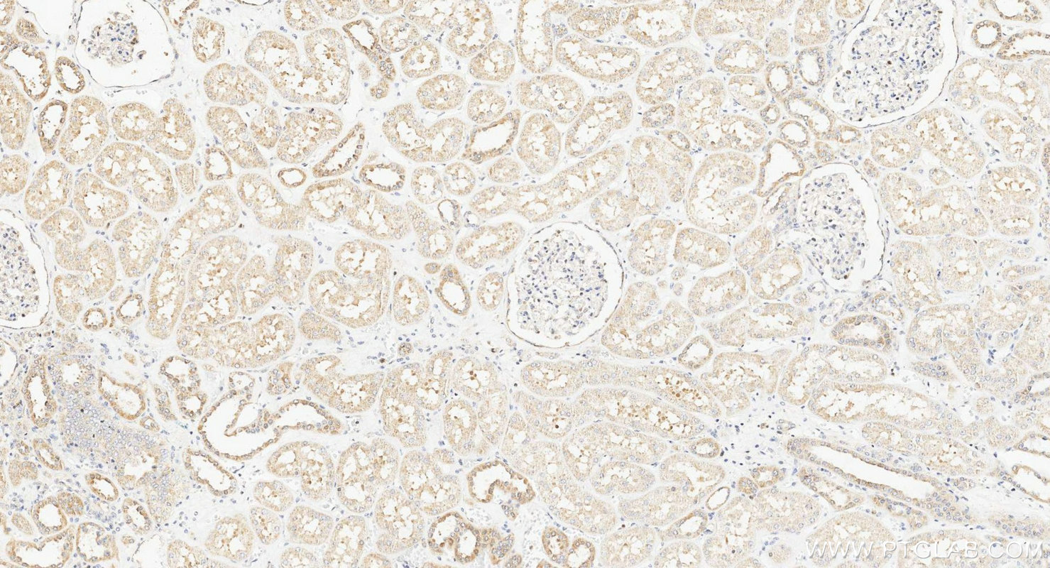 Immunohistochemistry (IHC) staining of human kidney tissue using TMEM61 Polyclonal antibody (20997-1-AP)