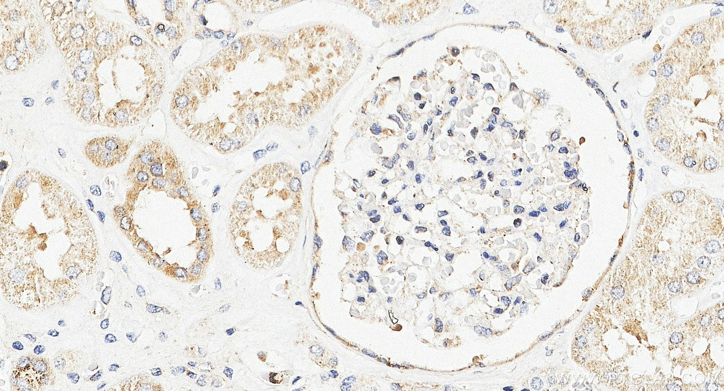 Immunohistochemistry (IHC) staining of human kidney tissue using TMEM61 Polyclonal antibody (20997-1-AP)