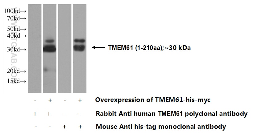 Western Blot (WB) analysis of Transfected HEK-293 cells using TMEM61 Polyclonal antibody (20997-1-AP)