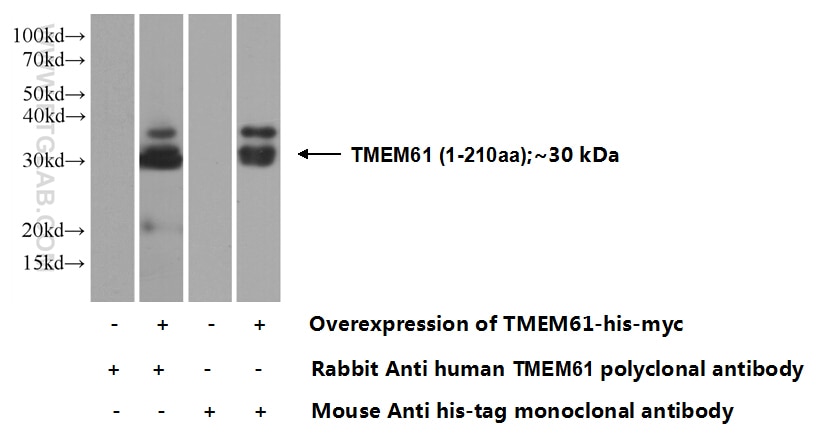 WB analysis of Transfected HEK-293 using 20997-1-AP