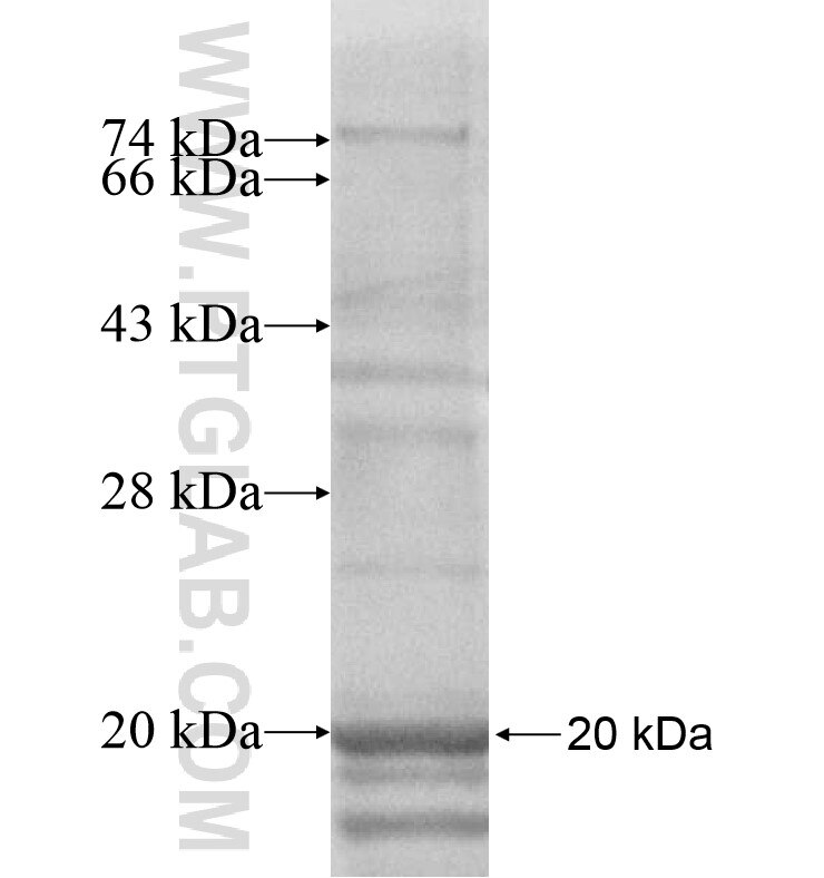 TMEM63A fusion protein Ag16911 SDS-PAGE