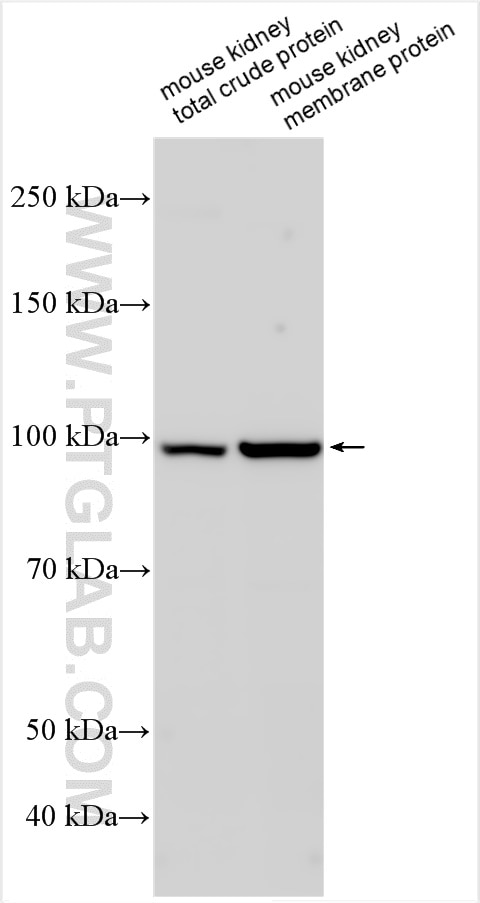 Western Blot (WB) analysis of various lysates using TMEM63B Polyclonal antibody (24226-1-AP)