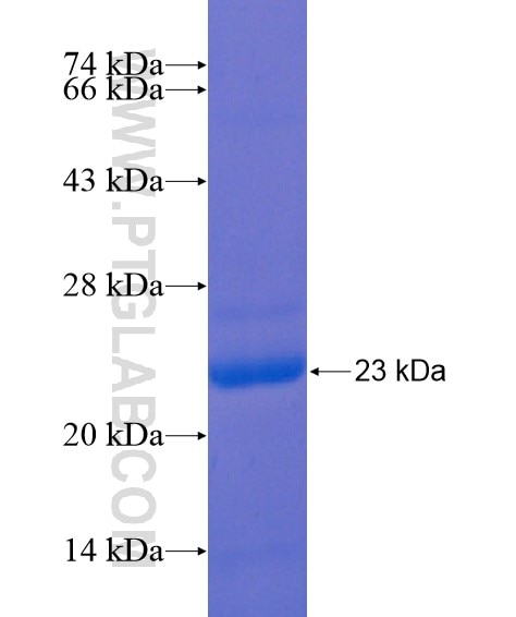 TMEM63B fusion protein Ag21573 SDS-PAGE