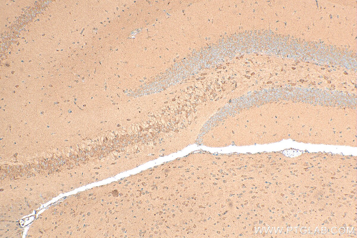 Immunohistochemistry (IHC) staining of mouse brain tissue using TMEM64 Polyclonal antibody (21274-1-AP)