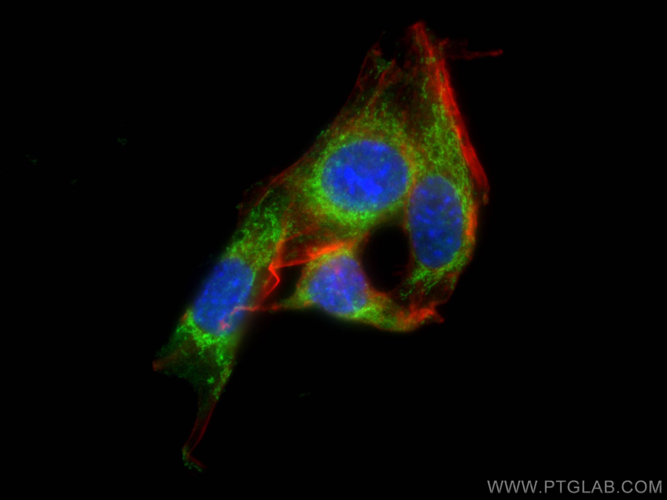 Immunofluorescence (IF) / fluorescent staining of NIH/3T3 cells using TMEM65 Polyclonal antibody (21913-1-AP)