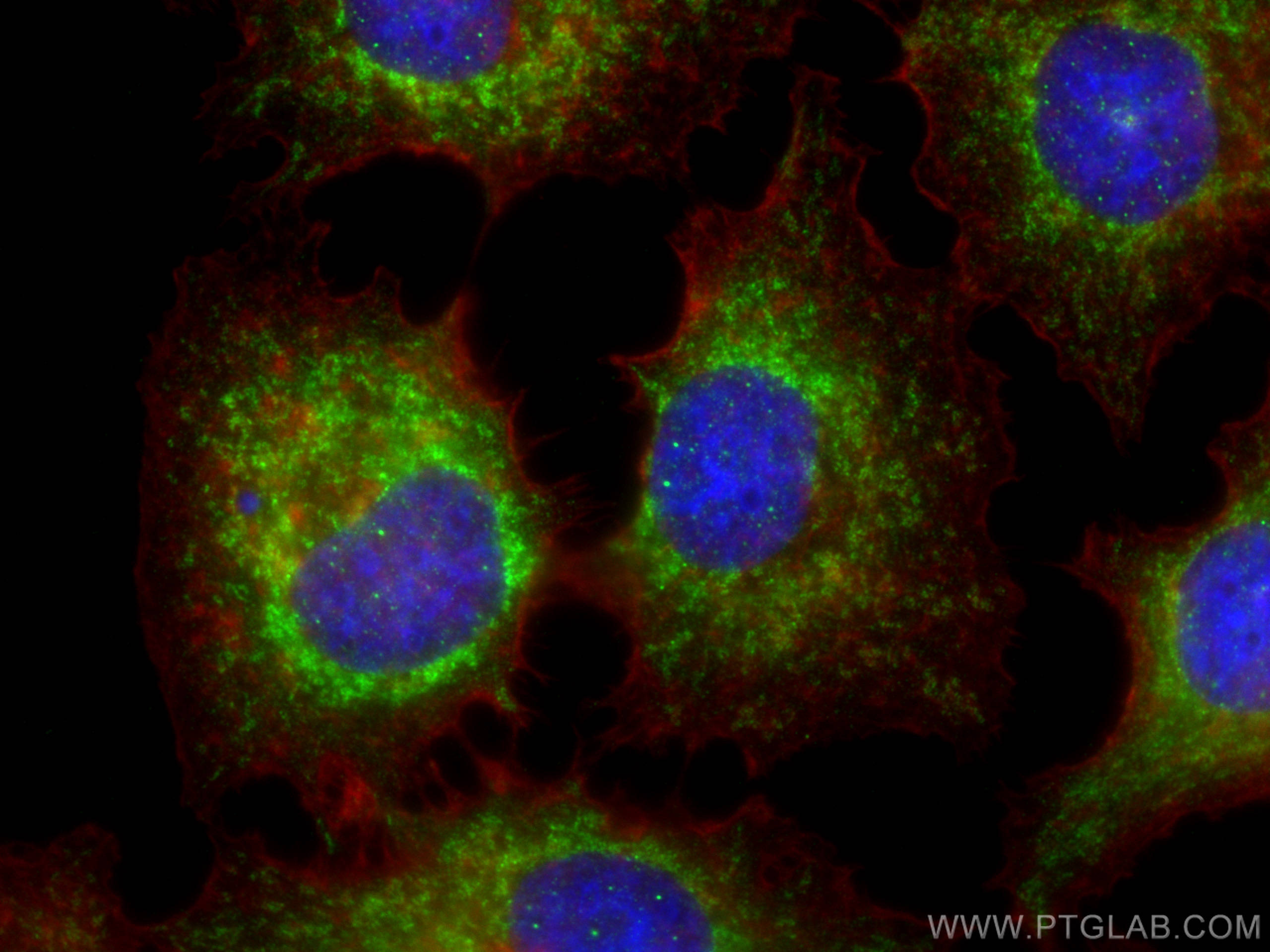 Immunofluorescence (IF) / fluorescent staining of Huh-7 cells using TMEM65 Polyclonal antibody (21913-1-AP)