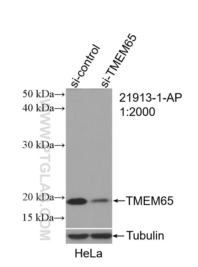 Western Blot (WB) analysis of HeLa cells using TMEM65 Polyclonal antibody (21913-1-AP)
