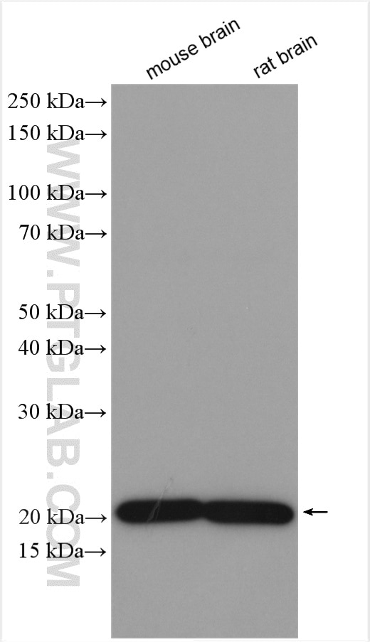 Western Blot (WB) analysis of various lysates using TMEM65 Polyclonal antibody (21913-1-AP)