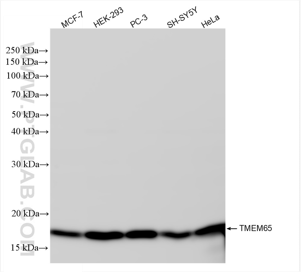 Western Blot (WB) analysis of various lysates using TMEM65 Recombinant antibody (83219-4-RR)