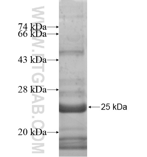 TMEM65 fusion protein Ag15509 SDS-PAGE