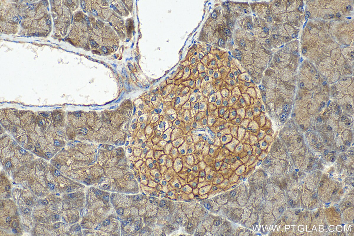 Immunohistochemistry (IHC) staining of mouse pancreas tissue using TMEM66 Polyclonal antibody (29599-1-AP)