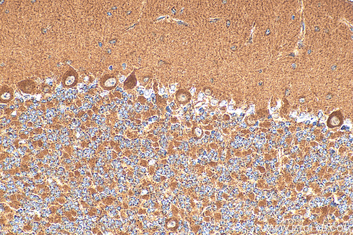 Immunohistochemistry (IHC) staining of mouse cerebellum tissue using TMEM66 Polyclonal antibody (29599-1-AP)