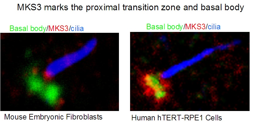 IF Staining of hTERT-RPE1 cells using 13975-1-AP