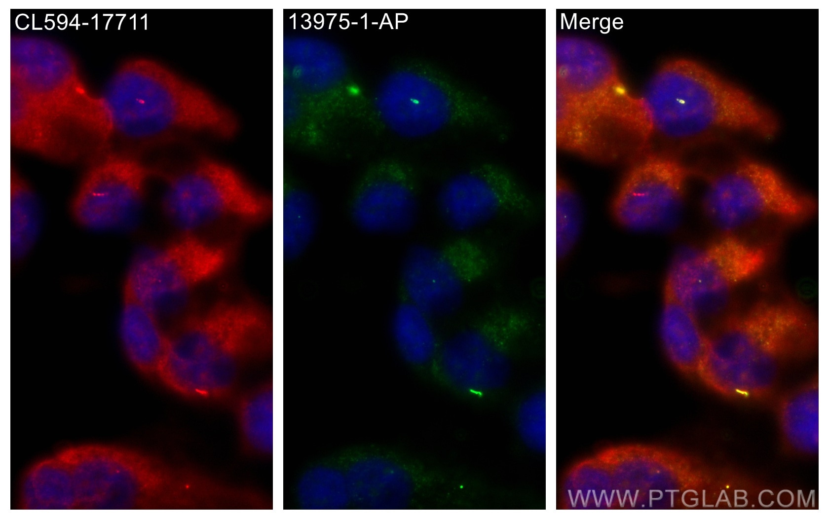 Immunofluorescence (IF) / fluorescent staining of hTERT-RPE1 cells using MKS3 Polyclonal antibody (13975-1-AP)