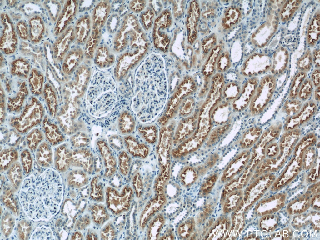 Immunohistochemistry (IHC) staining of human kidney tissue using MKS3 Polyclonal antibody (13975-1-AP)