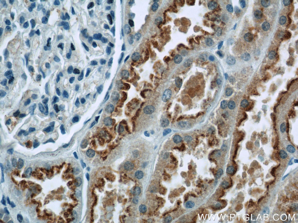 Immunohistochemistry (IHC) staining of human kidney tissue using MKS3 Polyclonal antibody (13975-1-AP)