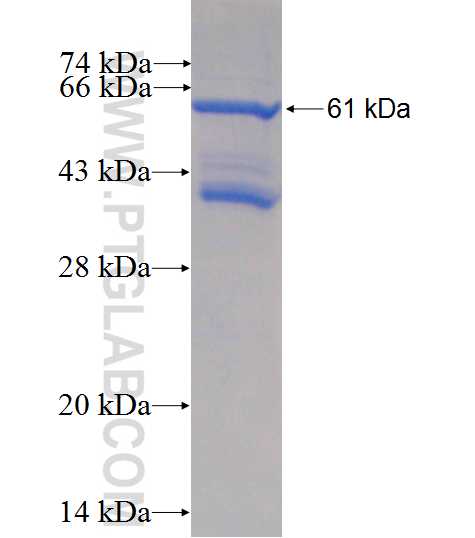 TMEM67 fusion protein Ag5009 SDS-PAGE