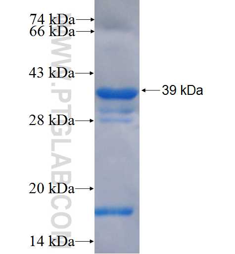 TMEM67 fusion protein Ag5174 SDS-PAGE
