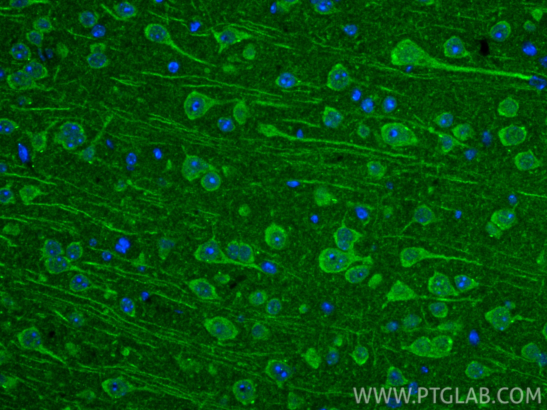 IF Staining of mouse brain using 20388-1-AP Immunofluorescence (IF) / fluorescent staining of mouse brain tissue using TMEM70 Polyclonal antibody (20388-1-AP)
