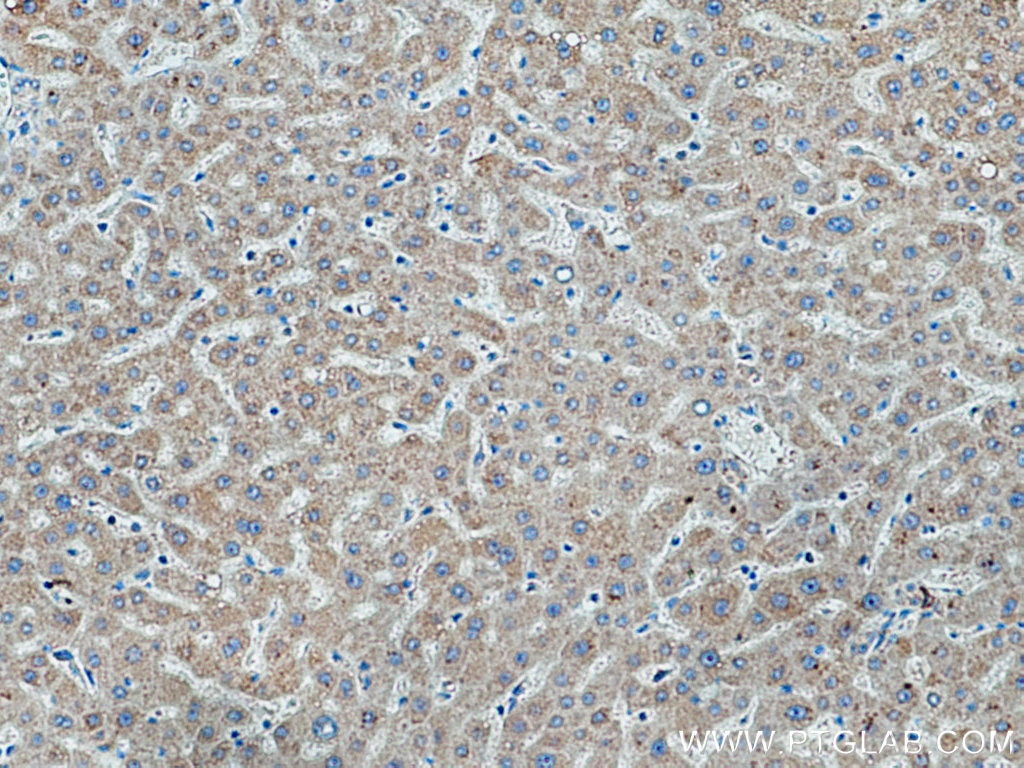 IHC staining of human liver using 20388-1-AP