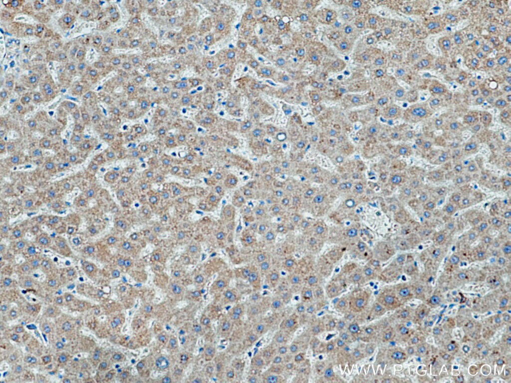 Immunohistochemistry (IHC) staining of human liver tissue using TMEM70 Polyclonal antibody (20388-1-AP)