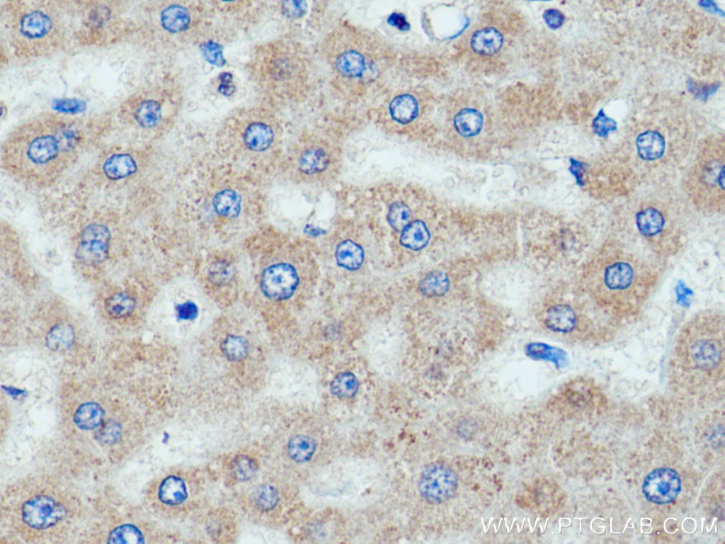 Immunohistochemistry (IHC) staining of human liver tissue using TMEM70 Polyclonal antibody (20388-1-AP)