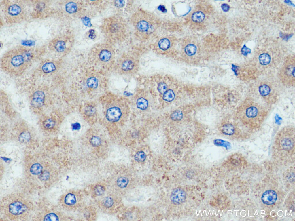 IHC staining of human liver using 20388-1-AP