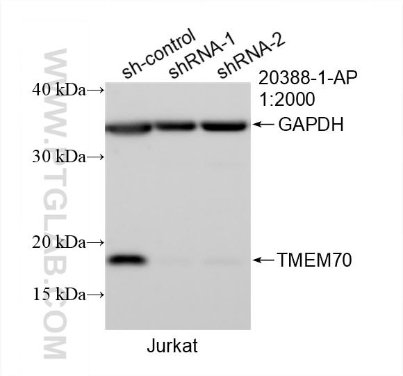 Western Blot (WB) analysis of Jurkat cells using TMEM70 Polyclonal antibody (20388-1-AP)