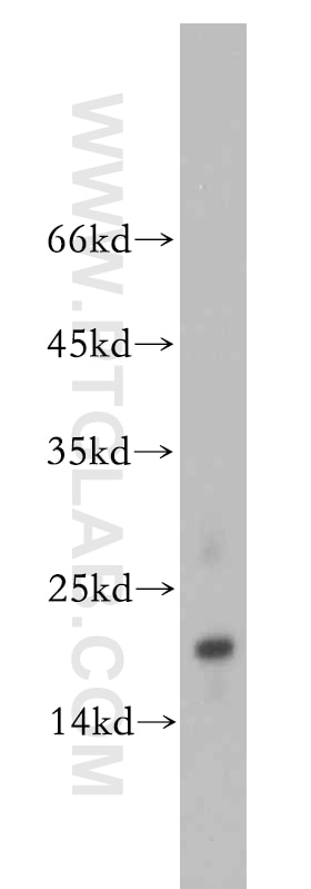 Western Blot (WB) analysis of A2780 cells using TMEM70 Polyclonal antibody (20388-1-AP)